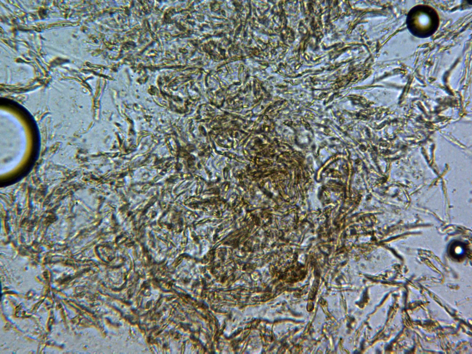 11 - Suprapellis agua x 400